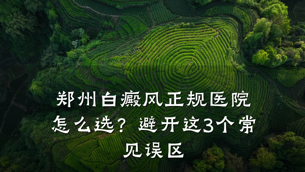 郑州白癜风正规医院怎么选?避开这3个常见误区